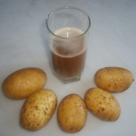 лечение геморроя картофельным соком